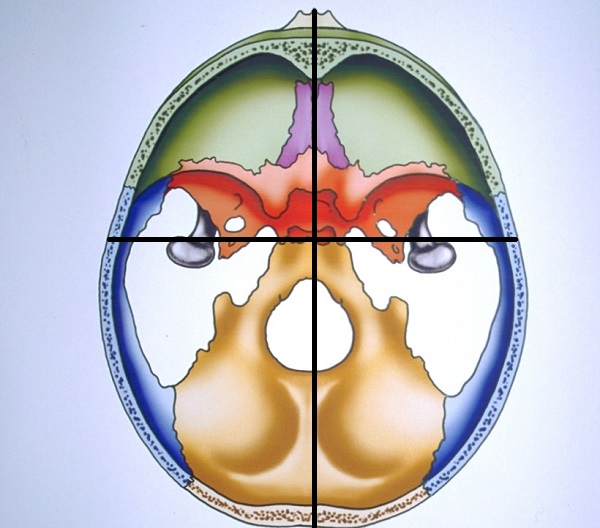 Fig. 2 Each quadrant is described by its relationship to the antero-posterior axis of the cranial base. It is said to be internally rotated when the structures in the quadrant are nearer the mid-line. It is externally rotated when they move away from the mid-line The quadrants can also displace in an upward or downward direction. These possibilities underlie the huge variation we see in the human face. 