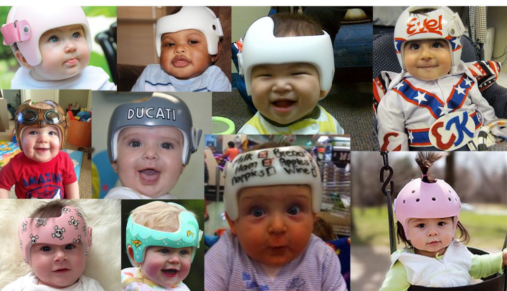 Infants in helmets